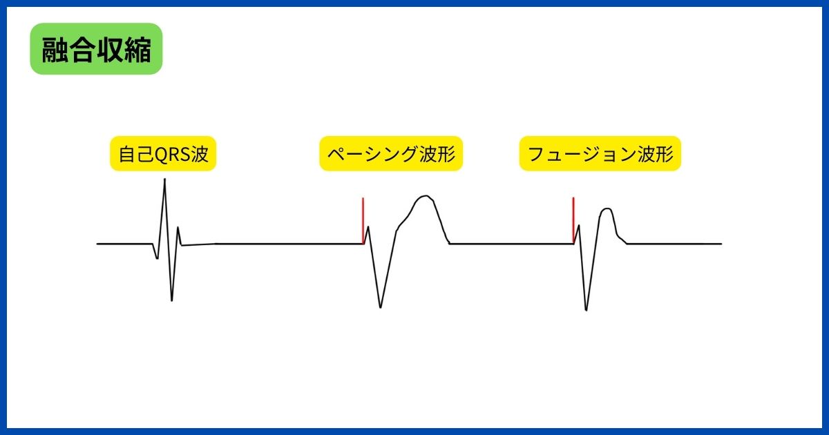 トラブルシューティング その2 | CEスタディ